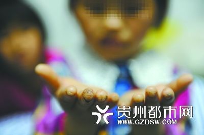 指尖被針扎得傷痕累累。