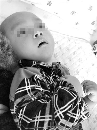 9月10日，陳揚(yáng)躺在醫(yī)院的病床上，他的眼睛仍然沒有聚焦感。新京報(bào)記者 朱柳笛 攝