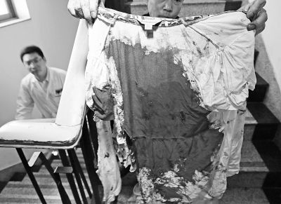 何女士的上衣被血浸透。記者楊濤攝