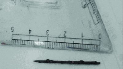 取出的繡花針已發(fā)黑生銹。