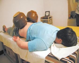 拔泡菜壇子火罐。