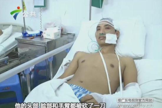 另一名傷者頭部、臉部和手臂都被砍了一刀。(視頻截圖)