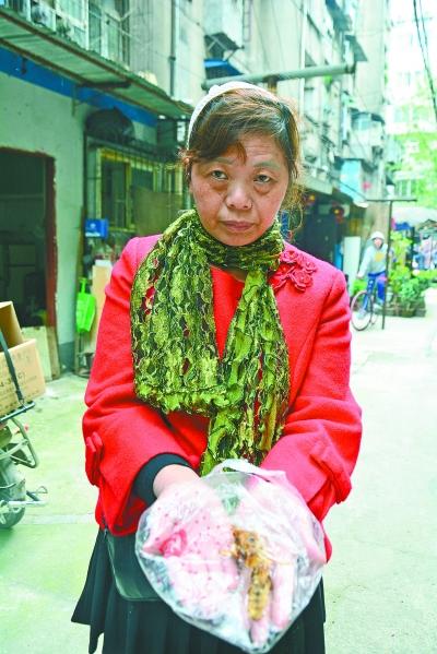 頭部受傷的黃女士展示兩根大魚(yú)刺。