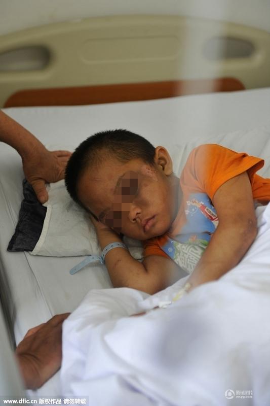 圖為全身傷痕累累的小進(jìn)。