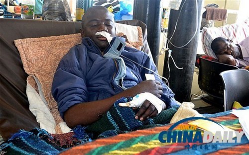 雖然已經(jīng)在醫(yī)院接受了近一個月的恢復(fù)治療，卡托卡的身體仍然非常虛弱。