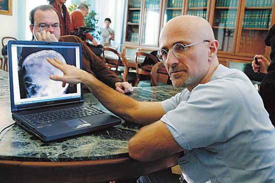 圖為卡納維洛醫(yī)生，不少人認(rèn)為他的想法非常瘋狂