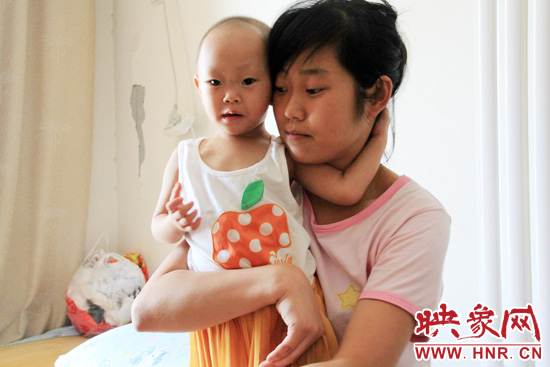 孩子和媽媽在一起，她的右眼已經(jīng)失明。