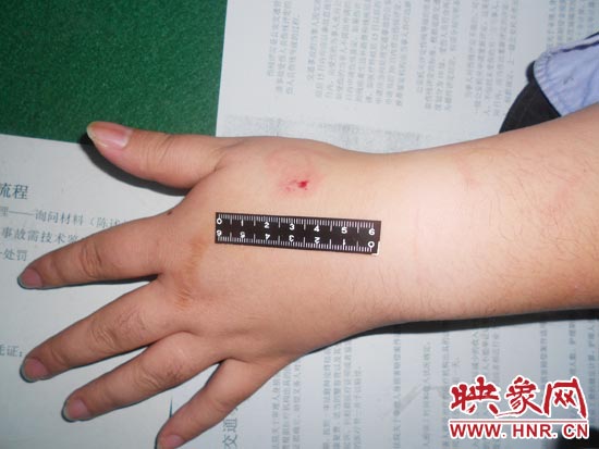 為幫助無證駕駛的朋友逃避處罰，新鄉(xiāng)的王某竟對(duì)執(zhí)勤民警大打出手，還將一名民警的手臂咬傷