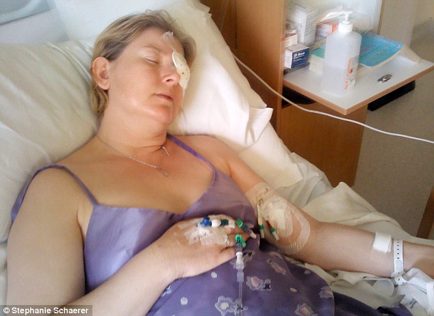 恐怖慎入！隱形眼鏡致英女子摘除眼球