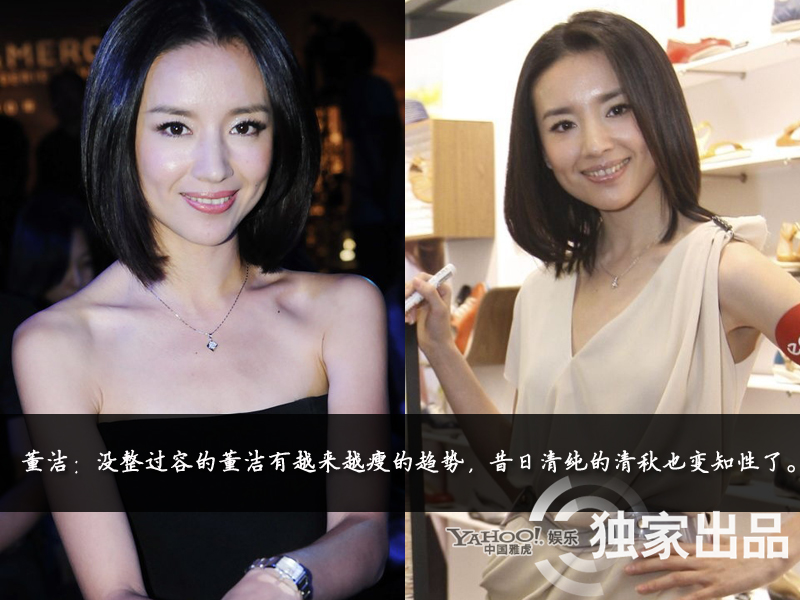 娛樂(lè)圈整容成風(fēng) 娛樂(lè)圈整容成風(fēng)