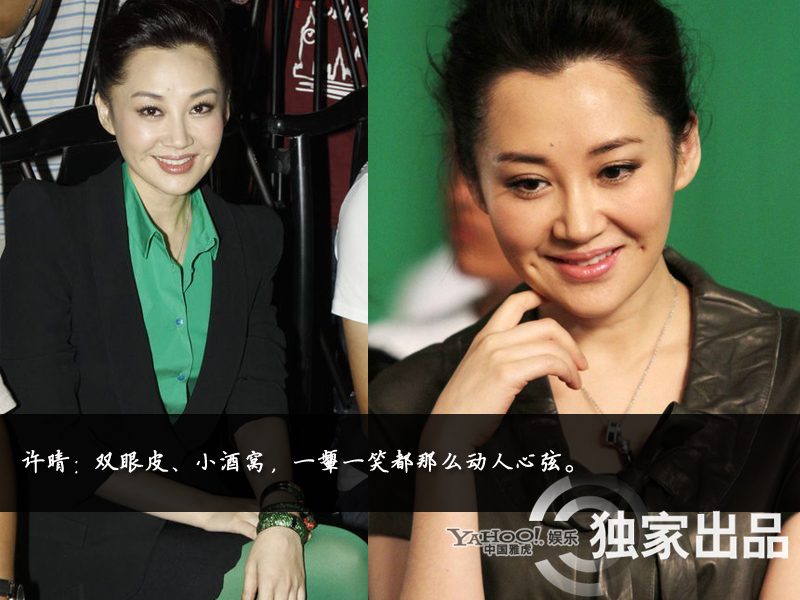 娛樂(lè)圈整容成風(fēng):揭露未動(dòng)刀的天然美女 娛樂(lè)圈整容成風(fēng):揭露未動(dòng)刀的天然美女