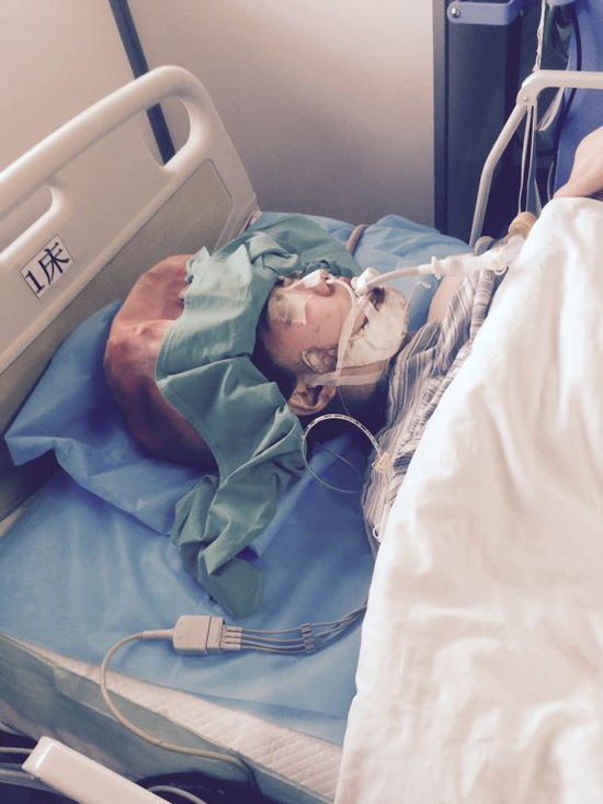 女海歸上海削骨整形 疑因術后出血誘發(fā)癲癇