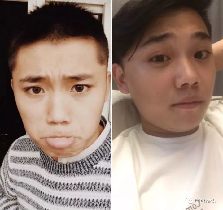 長胖20斤，臉型怎么變？這些例子看完扎心了！