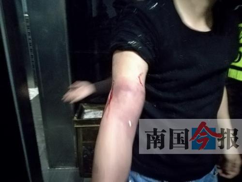 覃先生手臂被卡的部位受傷流血，所幸傷勢(shì)無大礙。 通訊員 王建民 攝