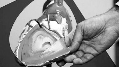 威廉斯領(lǐng)導的研究團隊已經(jīng)利用人體脂肪干細胞，成功3D打印出心臟血管和心臟瓣膜，待一顆心臟的所有部件打