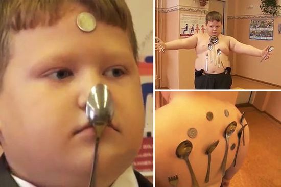 俄男孩被電擊后變“磁鐵人”稱(chēng)要當(dāng)“英雄”