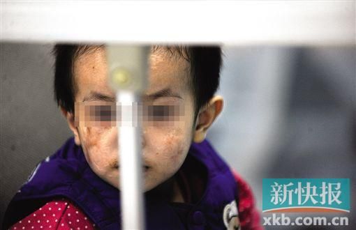 去年3月就能出院的小華(化名),目前還在廣州市婦兒醫(yī)療中心的PICU里住著。新快報(bào)記者 孫毅/攝