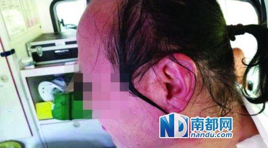 涉事教師遭熱水潑臉后的照片。