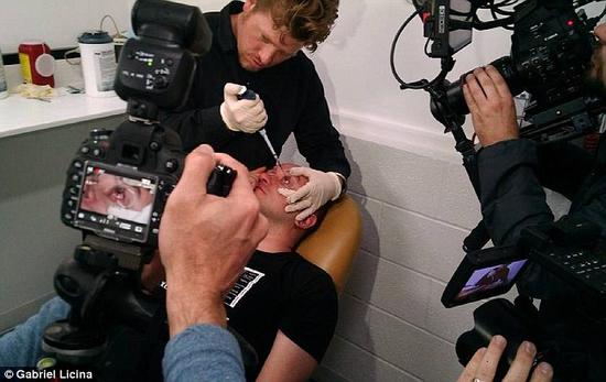 該實驗是由加州一支名為“生物駭客”的實驗團隊開展的。他們使用了一種名為二氫卟吩e6（Ce6）的物質(zhì)的溶液。Ce6常見于深海魚體內(nèi)，有光敏特性，通常用于癌癥治療研究中。研究團隊將Ce6與胰島素和鹽水混合起來，得到一種溶液，可以在低光照條件下提高人類的視力。