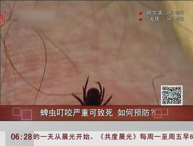 蜱蟲叮咬嚴重可致死如何預(yù)防？