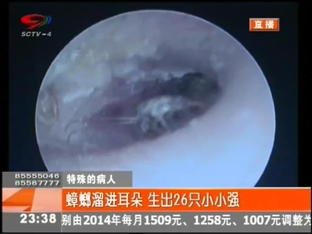 小強溜進耳朵？生26只小小強